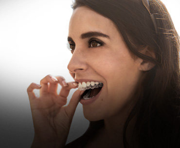 Align Invisalign and Fixed Braces